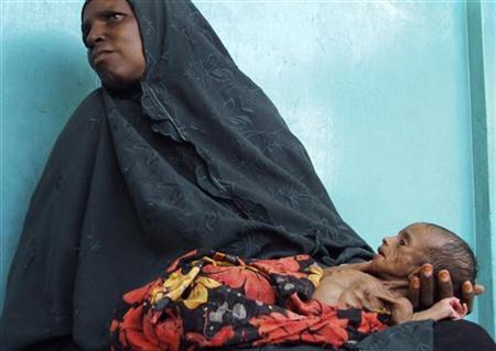 World Food Aid At 20-Year Low, 1 Billion Hungry Photo: A Somali woman holds her malnourished child along the corridors at Banadir hospital in the capital Mogadishu, August 10, 2009.