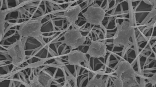 Fibroblasts growing on Dr. Brian Amsden's polymer fiber 