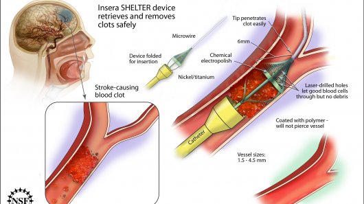 SHELTER device traps and removes blood 