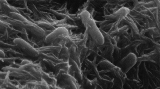 Shewanella bacteria, which produces ketones that are processed into fuel(Image from 'Culti...