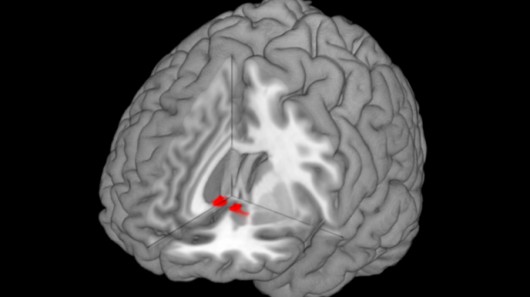 Close neurological ties between reward-processing and pain-processing regions in the brain...