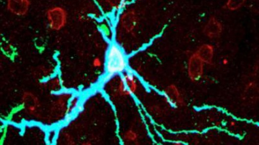 A neuron in a rat brain's cortex over-expressing PKMzeta shown in blue (Image: Todd Sackto...