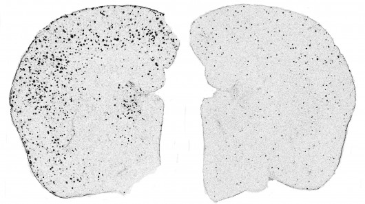Plaque deposits in the brain tissue of an untreated mouse (left), and one treated in the s...