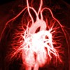 Angiogram of blood vessels in and around the heart