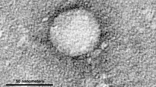 Electron micrographs of hepatitis C virus purified from cell culture