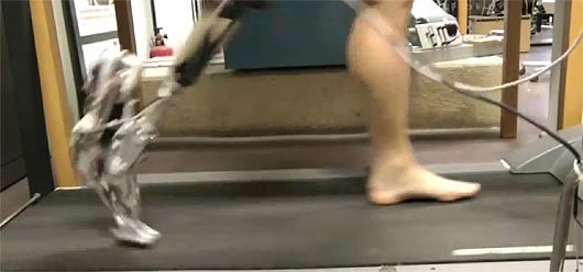 An amputee tests the AMP-Foot 2.0 on a treadmill