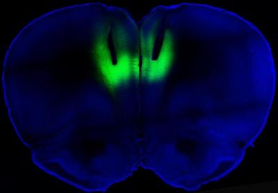 The green fluorescence indicates the firing of neurons, in the prefrontal cortex of one of...