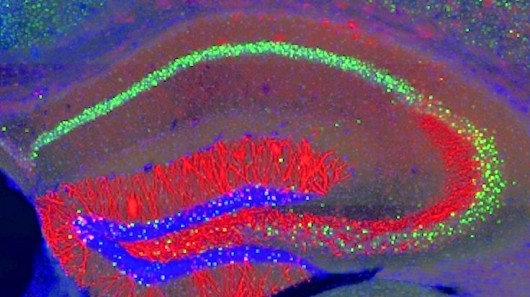 MIT neuroscientists identified the cells (highlighted in red) where memory traces are stor...
