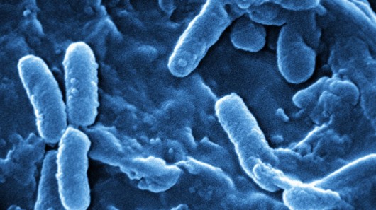 Blue light has been used to kill potentially-lethal Pseudomonas aeruginosa bacteria (pictu...