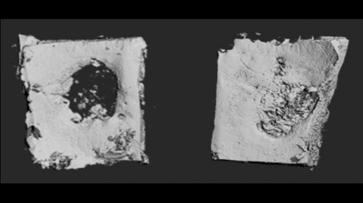 Scientists have created a collagen-based patch that uses synthetic DNA to stimulate bone g...