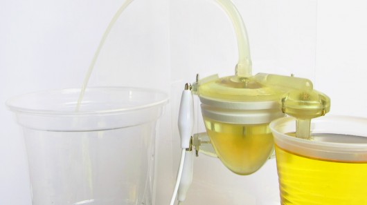 This artificial muscle-driven heart pumps human urine and will be used to power the Ecobot...
