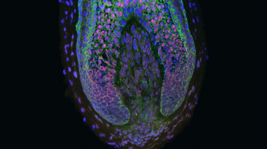 Researchers have created new human hairs using dermal papilla cells found inside the base ...