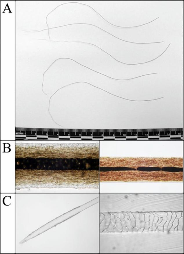 A microscopic hair examination shows a variety of hair shaft profiles found. The full length of the hairs was approximately 15 cm and diameters ranged from 80 to 110 m. Human head hairs typically range from 55 to 100 m in diameter.