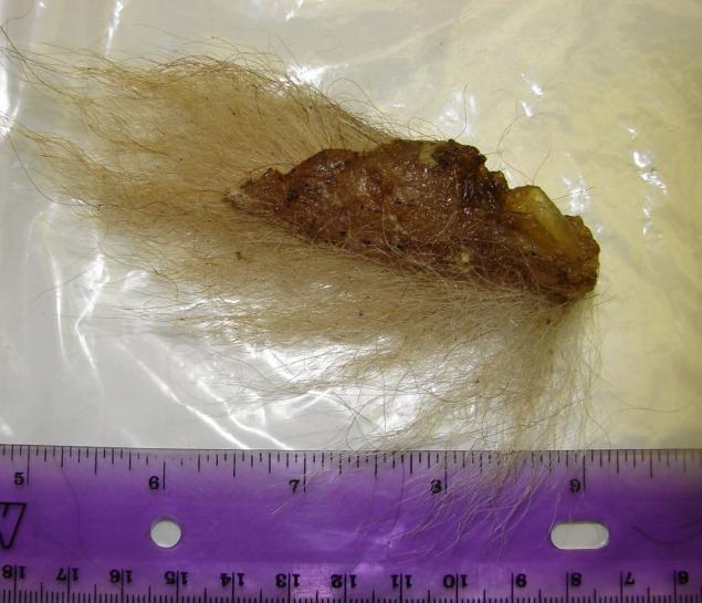 A tissue sample believed by the researchers to have been taken from a real-life Bigfoot is seen. The hair is described as far more coarse like a horse's than a human's.