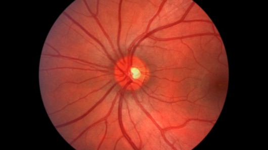 iPhones can now be used to obtain high-quality images of the retina  (Photo: Shutterstock)...
