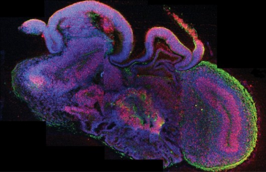 A lab-grown mini-brain (Photo: Institute of Molecular Biotechnology)