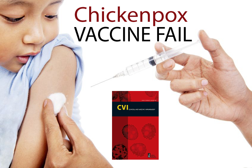 Chickenpox Vaccine When Mandated INCREASES Disease Outbreak, South Korean Study Finds