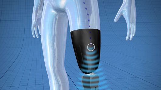 The Ossur system uses implanted sensors sending wireless signals to the artificial limb's built-in computer