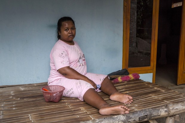 Dwi Sarnawati, 19, who suffers from Down Syndrome, sits in front of her house at Krebet Village in Jambon subdistrict on March 23, 2016 in Ponorogo district, Indonesia. Dwi has been paralysed, mute and deaf since she was 7-years old. (Photo by Ulet Ifansasti/Getty Images) 