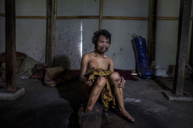 Saimun, 45, lies on the ground inside his house, where his legs have been chained for 20 years by his parents because he suffers from mental illness in Jambon subdistrict on March 23, 2016 in Ponorogo district, Indonesia.