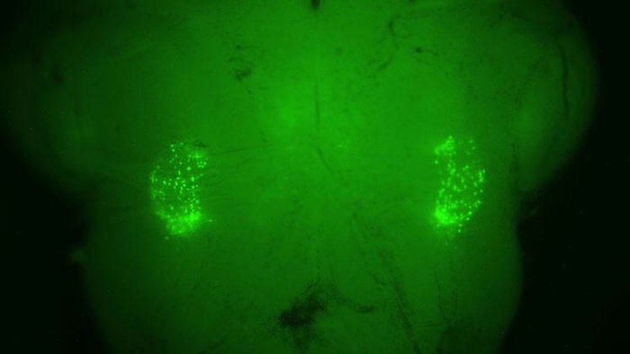 A fluorescent-green marker on each side of the brain stem illuminates the two networks of 200 ...