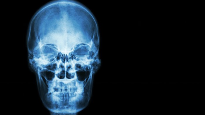 The successful isolation of stem cells for skull and face bones could lead to new treatments ...