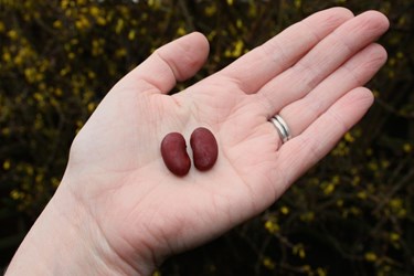 kidneybeans