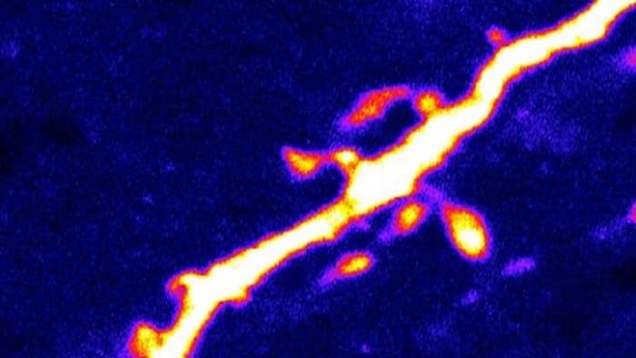 Dendric spines that transmit signals between neurons could show scientists how the protein AMPK communicates with ...