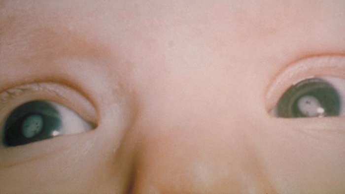 The researchers have already conducted clinical trials for the new approach, with the results showing less ...