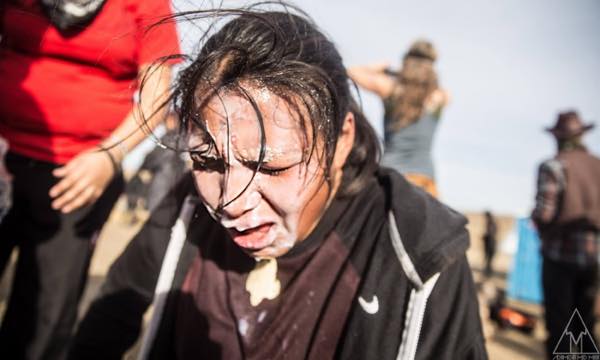 A water protector who has been maced in the face. Police doused unarmed people at point-blank range with mace shot from fire-extinguisher-sized containers as forcefully as water from a high-powered garden hose. (Photo: Adam Alexander Johansson)