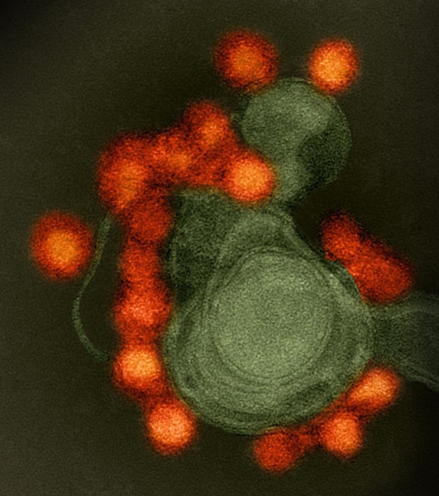 Transmission electron microscope image of negative-stained, Fortaleza-strain Zika virus (red)